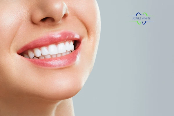Safe and effective laser whitening treatment for visibly whiter teeth Middlesbrough