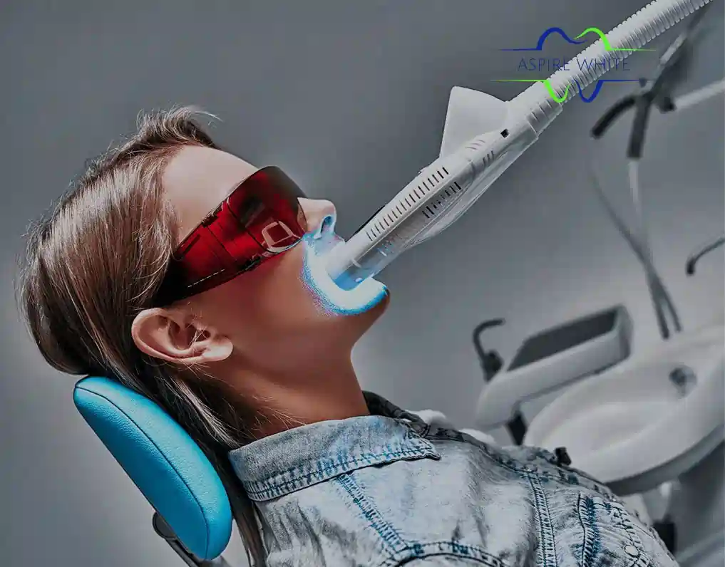 1 Hour Teeth Whitening with Aspire White Middlesbrough