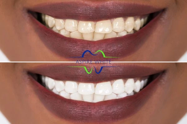 Side-by-side comparison showing before and after results of a cosmetic treatment Middlesbrough