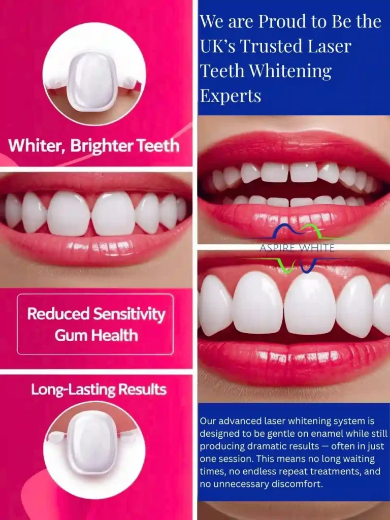 We are Proud to Be the UK’s Trusted Laser Teeth Whitening Experts Middlesbrough